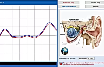 physioscan
